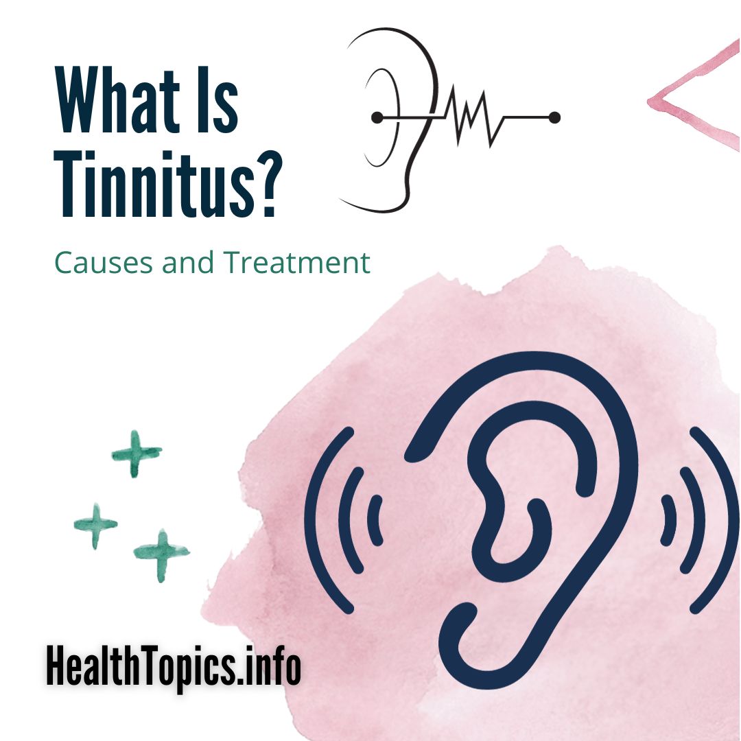 टिनिटस tinnitus